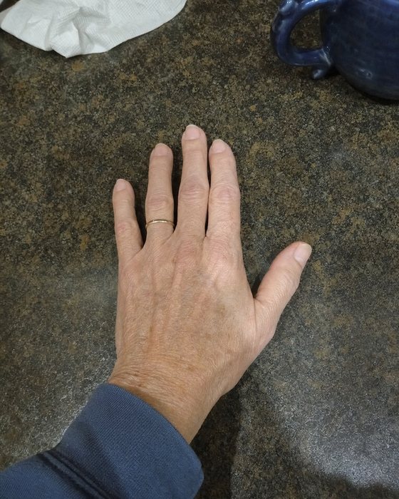 Day 1